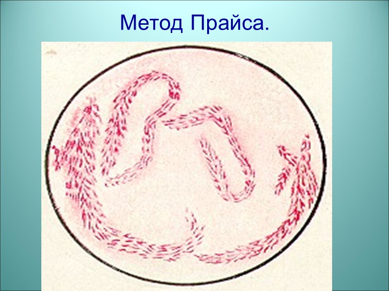 Метод Прайса.